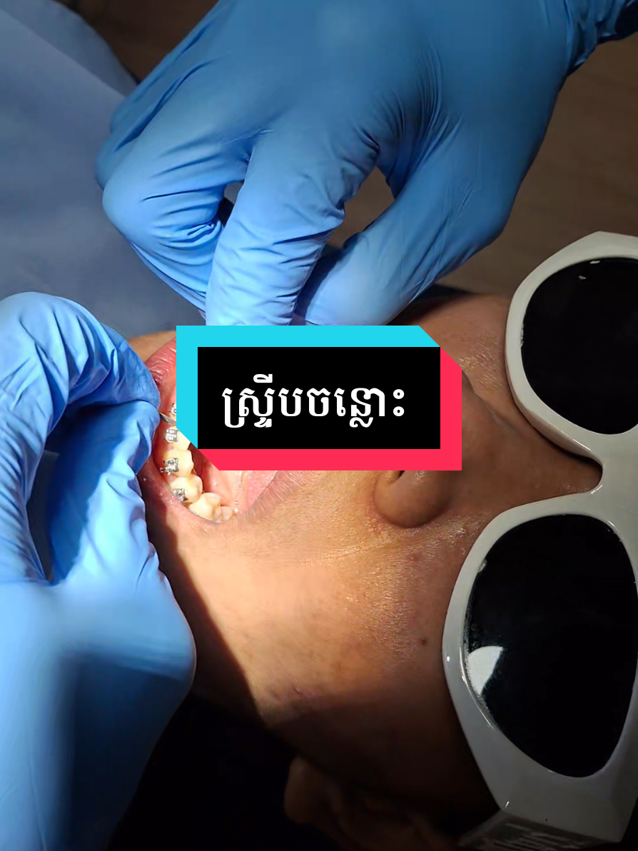 check up ដូរកៅស៊ូ #ធ្មេញដែក #ព្យាបាលធ្មេញ #teamធ្មេញដែក #braces #គ្លីនិកធ្មេញគ្រេតស្មាល #fyp 