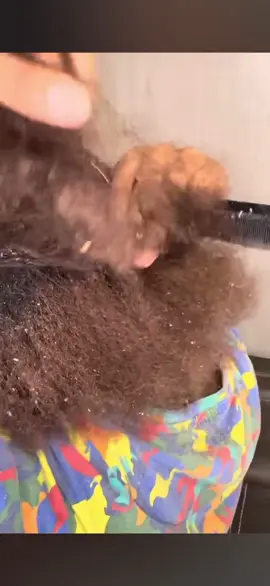 #dandruffremovel #dandruff #dandruffscratch #scratchingsounds #scratchingasmr 