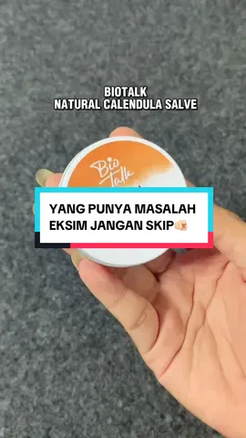 Yang punya permasalahan eksim harus banget cobain BioTalk Natural Calendula Salve ini🫵🏻 @Biotalk.id  #BiotalkEksim #Eksim #KulitSensitif 