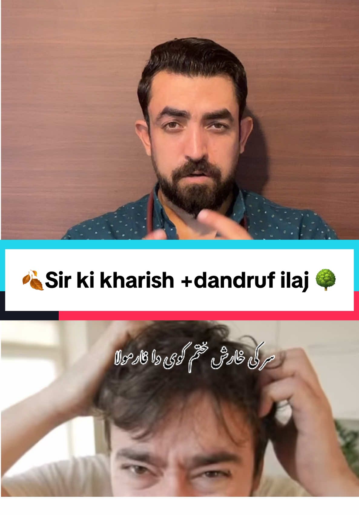 Sir ki kharish lre no da use ka formula end ka sta @Dr ahmed khan #drahmedkhan #foryou #fyp #standwithkashmir #tiktokviral #foroupage #viral #afghanistan #pregnancy #tiktok #pakistan #afghanistan🇦🇫 #treatment #tiktokindia #tiktokindia #hairstyle #vir #afghanista 