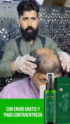 ✨ ¡Dile adiós a la caída del cabello con este tónico mágico! ✨ El tónico capilar Ouhoue con ginseng y biotina hará que tu pelo crezca como nunca. 🤩 Fortalece, nutre y revitaliza desde la raíz. 💪 ¡Aplícalo diario y presume pelazo! 💁🏻‍♀️ #cabello #hairtok #crecimientocapilar #ouhoue #pelazo #beautyhacks
