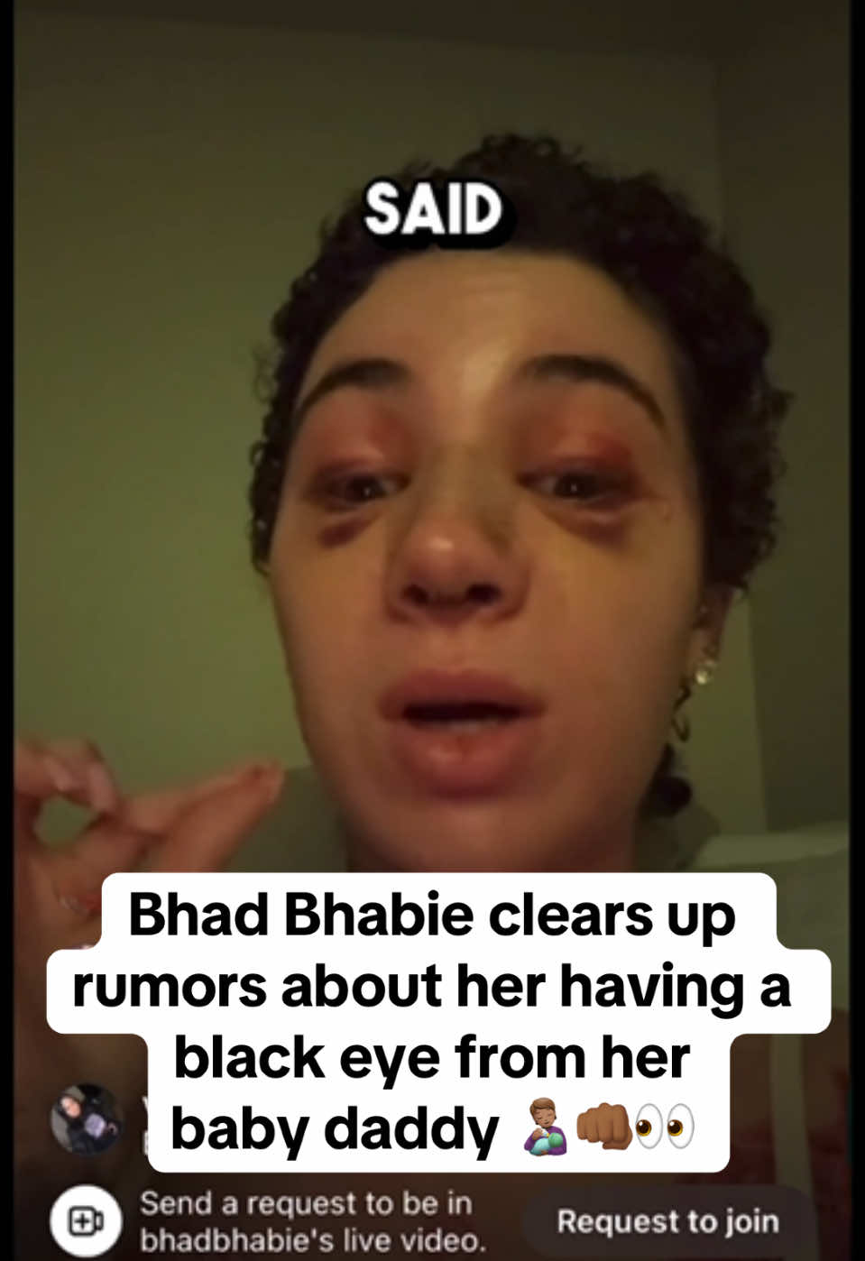 Bhad Bhabie clears up rumors about her having black eyes from her baby daddy | IG LIVE 1/21/25 @Danielle #bhadbhabie #daniellebregoli #bhadbhabieedit #blackeye #nosejob #nosejobcheck #surgerytiktok #surgerytok #bbl #bblrecovery #nosesurgery #babydaddy #babydaddyproblems #babymama #babymomma #drama #BlackTikTok #blacklivesmatter #blackgirl #blackcommunity #blackcreators #blackcontentcreator #blackcouple #blowup #blowthisupforme #tiktokban #fyp #fypシ #fypシ゚viral #fyppppppppppppppppppppppp #viral 