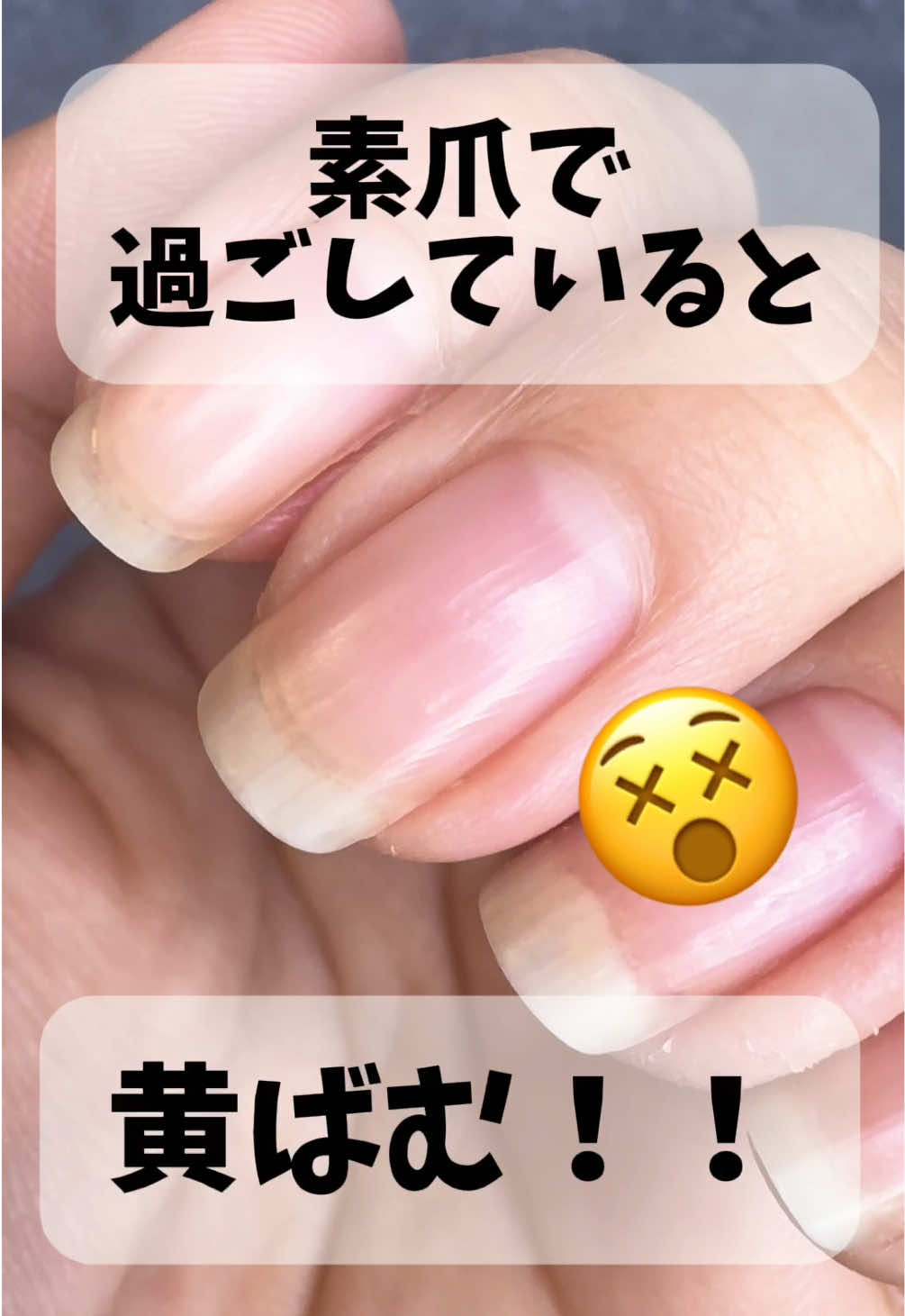 🟡黄ばむ私たちのお助けアイテム！🟡 #自爪 #自爪育成 #甘皮#ネイルケア #爪 #ネイルオイル#恵比寿 #駅近 #マニキュア #ジェルネイル #美爪 #ネイル