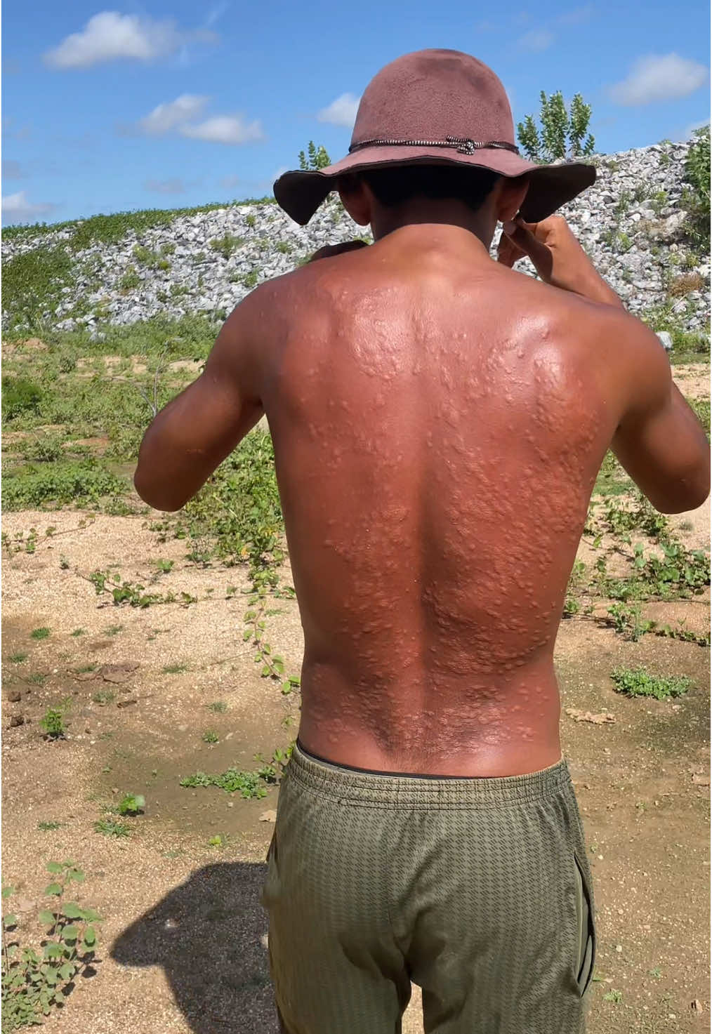 Resultado  de ter colocado Ortiga nas costa