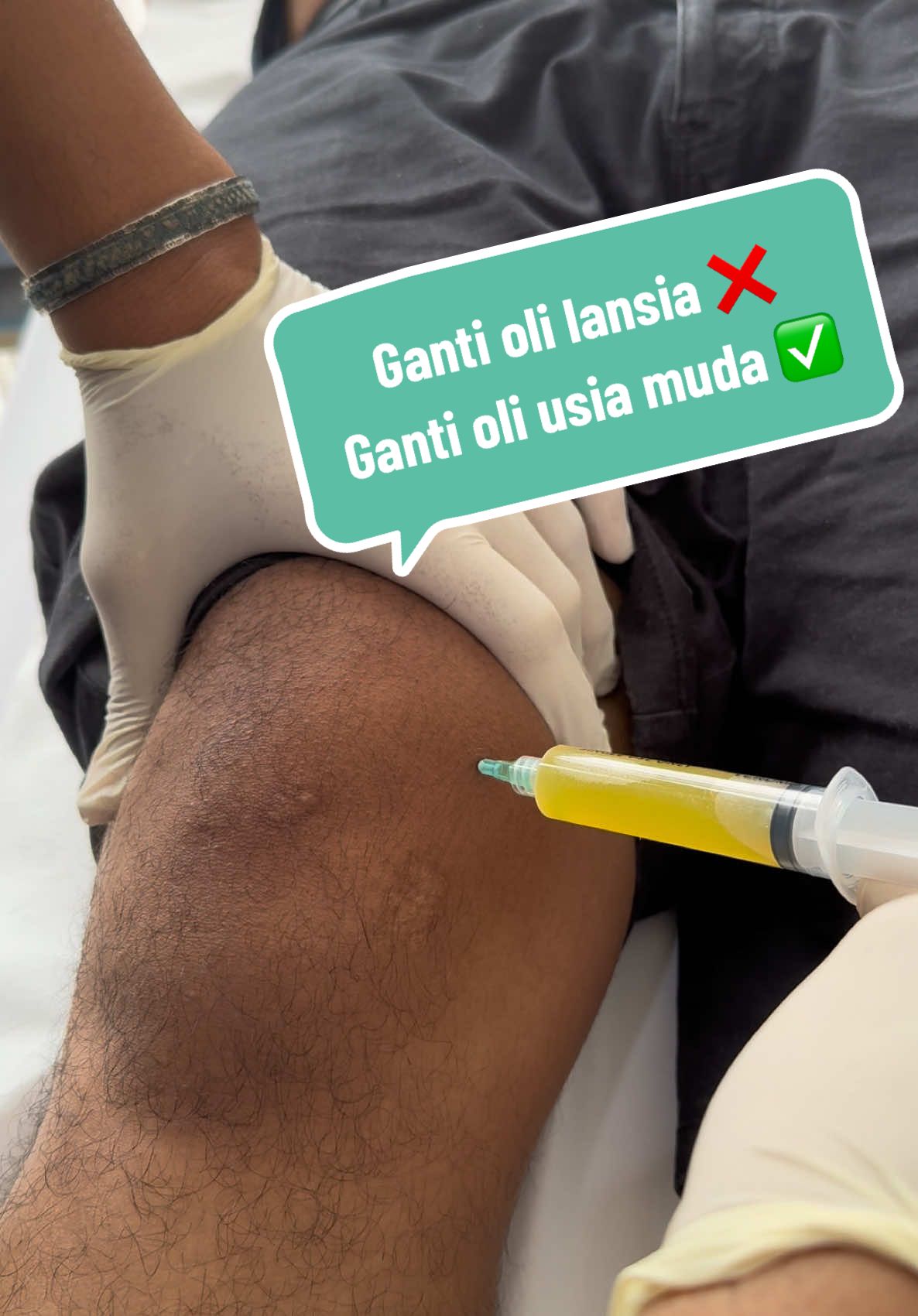 Lutut kamu sakit, nyeri, bengkak?? Udah buruan ke dokter ortopedi aja, mau sampe kapaann?? Ini usia muda loh, keep langsing ya kawan 🥰❤️ #dokter #dokterortopedi #dokterbedahtulang #orthopedics #orthopedicsurgeons #ronsenajadulu #kitagakgigit 