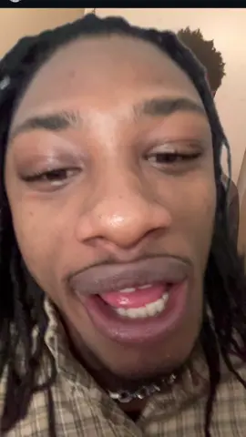 let ugly kid get a brand deal