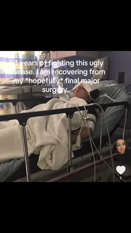 Recovering from this surgery has fucked me up mentally AND physically. It is a vibe not having an asshole 😂 But, we did it! We are done! We are in pain but healing still! Crohn’s disease is the devil, I have always said that. While I am not cured, and never will be, I am *better*  #collectomy #proctectomy #crohnsdisease #rollinwithnocolon #rollinwithnobutthole 