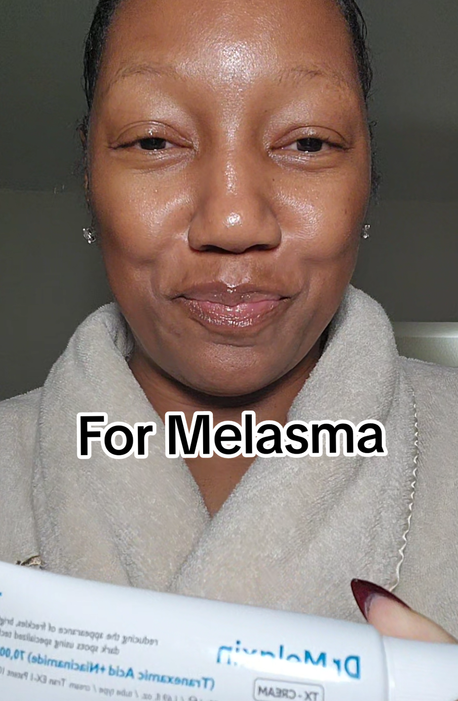 Replying to @cossette.cervante I love your results for you! #Melasma can be stubborn but bc @Dr.Melaxin 🫧 is designed to treat and correct the skin condition it's been working well!!!  #darkspots #melasma #DrMelaxin #darkcircles #hyperpigmentation #skincaretiktok #skincare #skincareroutines 