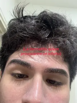 #dermatitisseborreica #viral #foryou #infarto 