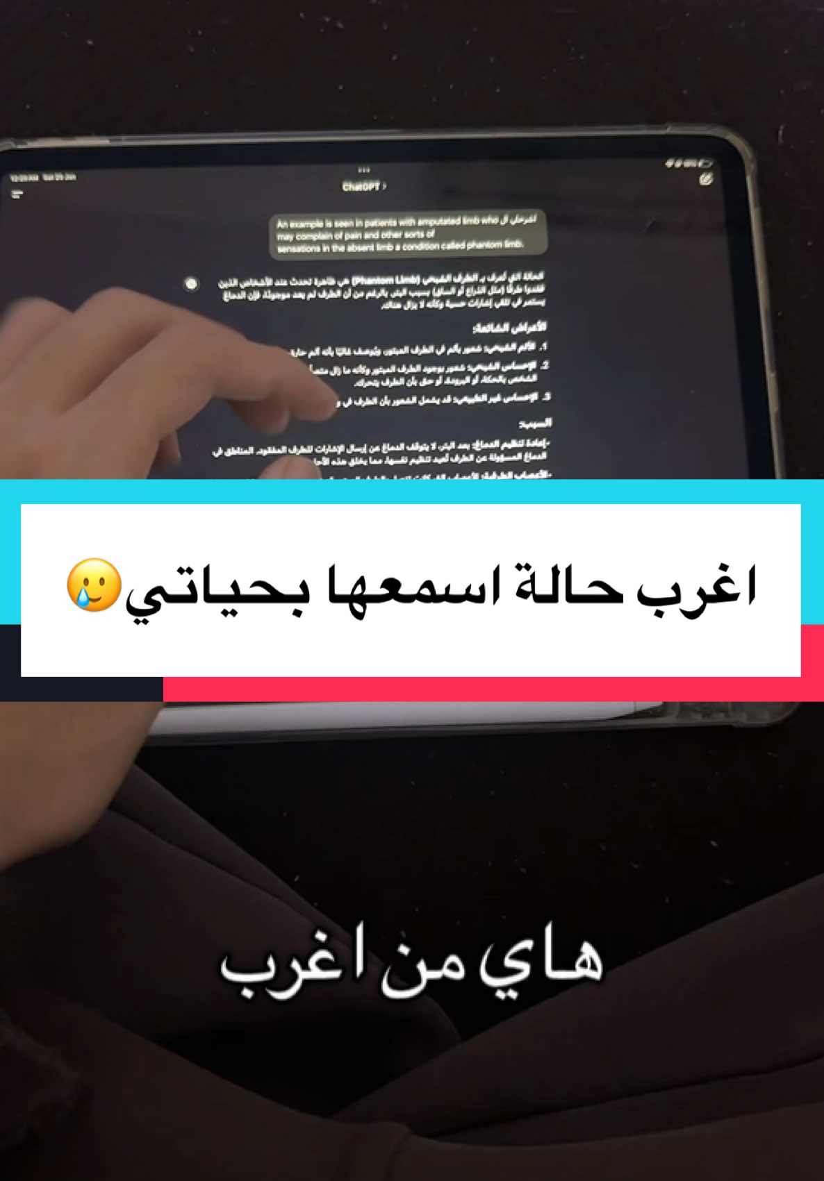 اغرب علاج سمعته بكل حياتي🥲 	•	#صحة 	•	#طب 	•	#الرعاية_الصحية 	•	#معلومة_طبية 	•	#نصائح_صحية 	•	#الوقاية_خير_من_العلاج 	•	#العلاج 	•	#الرعاية_الطبية 	•	#كلية_الطب 	•	#طالب_طب 	•	#حياة_طبيب 	•	#دراسة_الطب 	•	#طلاب_الطب 	•	#الطب_والحياة 	•	#طب_وجراحة 	•	#مستقبل_الأطباء 	•	#طبيب_المستقبل هاشتاقات تعليمية ومعلوماتية: 	•	#معلومة_صحية 	•	#تعليم_طبي 	•	#التثقيف_الصحي 	•	#حقائق_طبية 	•	#تعلم_الطب 	•	#معلومات_طبية 	•	#MedicalSchool 	•	#MedStudentLife 	•	#DoctorInMaking 	•	#FutureDoctor 	•	#Medicine 	•	#MedLife 	•	#HealthTips 	•	#MedicalEducation 	•	#طب_الأطفال 	•	#طب_النساء 	•	#جراحة 	•	#طب_الأسنان 	•	#علم_الأدوية 	•	#أمراض_القلب 	•	#طب_العيون 	•	#طب_الأمراض_الباطنية