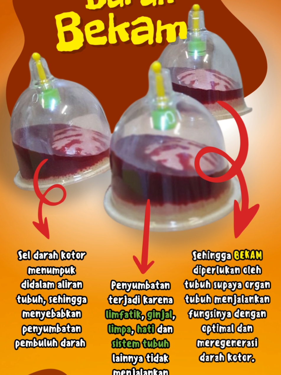 #berbekam #jakarta #bandung #bekamsunnah #bekamangin #cuppingmassage #bekamdarah #cuppingtherapy #bekamdatangkerumah #hijamatherapy #darahkotor #bekampanggilan #hijamah #berbekam #bekam #bekamsumedang #bekamjakarta #bekambandung #bekampria #bekamwanita 