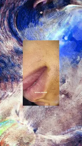 #squeezeyuk #satysfying #pimple #foryou #relax