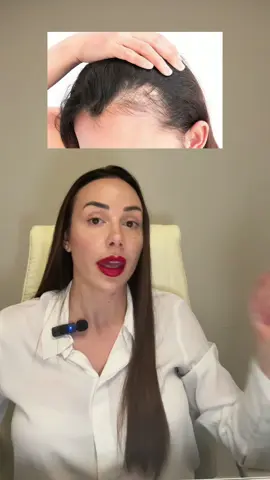 Te is tapasztaltál már kellemetlen hajhullást? 🤔 Ha személyre szabott segítségre van szükséged a fogyásban és a hormonális problémád kezelésében írj üzenetet instagramon: vivienm_fitness 📩 vagy nézd meg az ingyenes útmutatónkat a profilomban található linken. #hajhullás #hormonok #hormonálisegyensúly