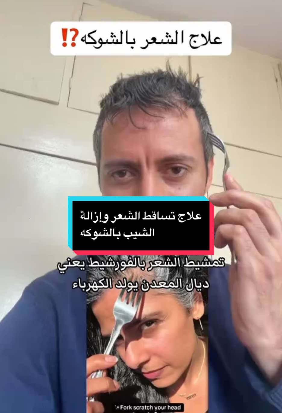 تجربتي مع ترند الشوكه الاستانلس في إزالة الشيب وحل كل مشاكل الشعر خرافه أم حقيقة #الشعر #الشيب #الشوكة #تطويل_الشعر #تقوية_الشعر #قشرة_الشعر #فراغات_الشعر #تساقط_الشعر #تساقط_الشعر_وعلاجه #علاج_الشعر #معالجة_الشعر #تكثيف_الشعر #العناية_بالشعر #علاج #وصفة #صحة_عامة #fourchette #cheveux #hair #trendingvideo 