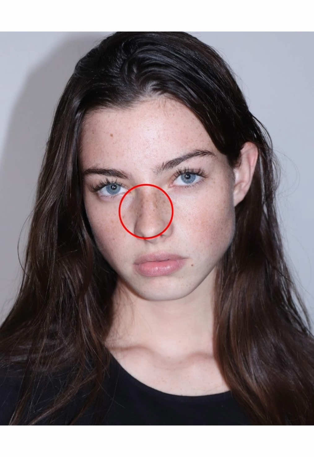 Facial Freckles Who owns it ?🧏🏻‍♀️ #beauty #lips #nose #explore #edit #fyp #foryou #fyp #foryoupage  #fffffffffffyyyyyyyyyyypppppppppppp  #viral #Love #tiktok #fypシ #viral #ff #capcut 