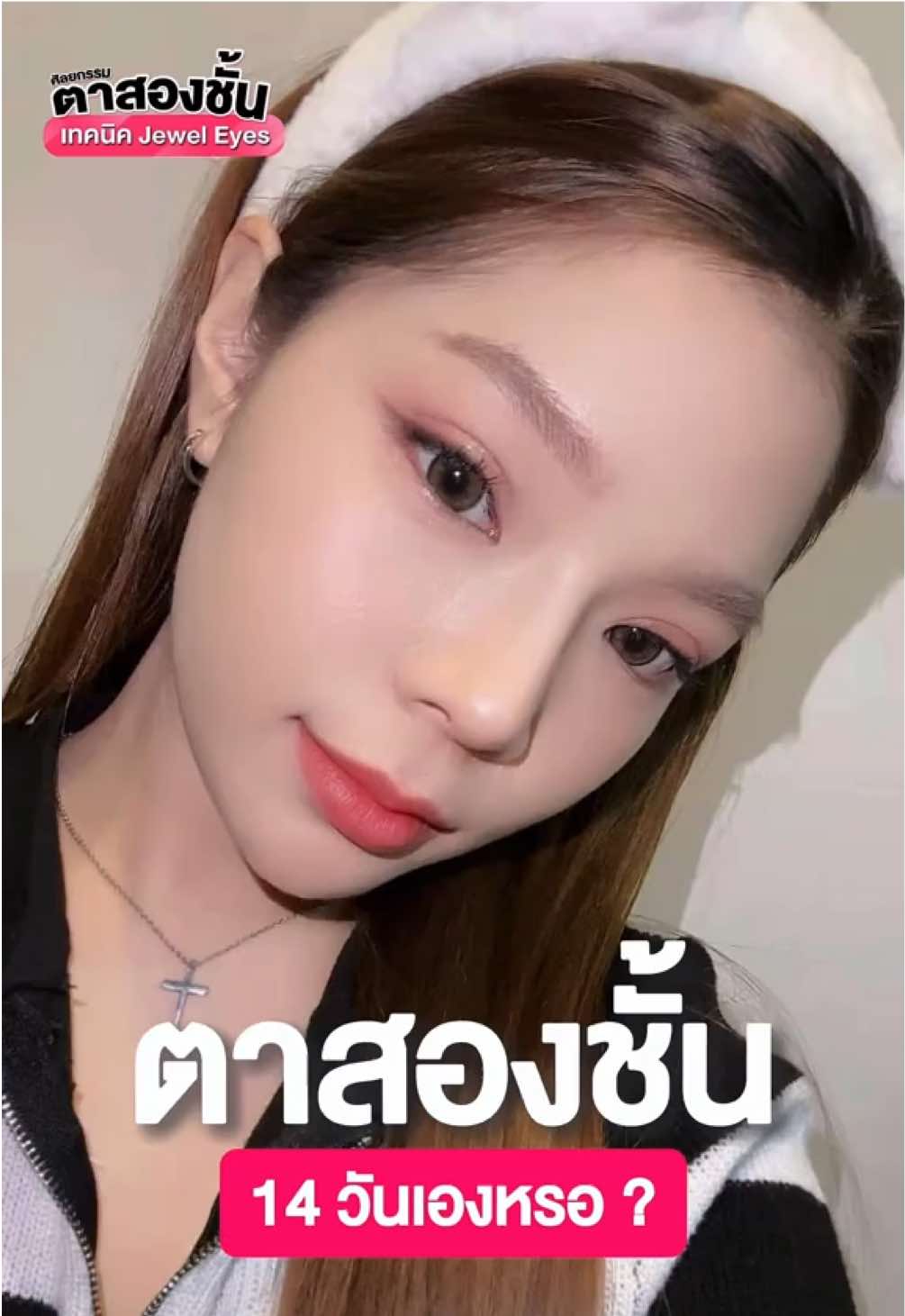 เคสนี้ชมไม่หยุด!  หลังเห็นชั้นตาไปดูกันว่าเป็นยังไงค่ะ ☺️✨👀    #theartclinic #ดิอาทคลินิก #ศัลยกรรมตาสองชั้นดิอาทคลินิก #ตาสวย #ตาสองชั้นดิอาท #หมวยอินเตอร์ #ทําตาสองชั้น #ตาสองชั้นกรีดยาว #หมอพลอยดิอาท #รีวิวตาสองชั้น #ตาหวาน #ตาไม่เท่ากัน #เอาขึ้นหน้าฟีดที  #ตามจังหวะ  #ตาหลบใน  @หมอพลอย 