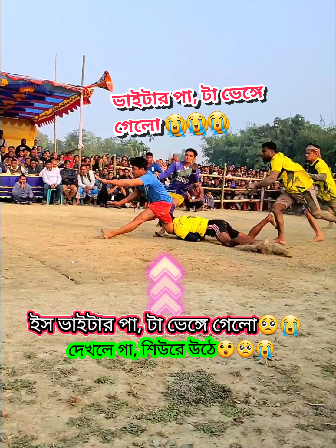 Replying to @sookpaki34 ভাইটার পা,টা ভেঙ্গে গেলো 😭😭😭সারা জীবনের জন্য ভাইটার খতি হয়ে গেলো 😭🥺#হাডুডু #2025 #trendingsund #viral #100kviews #foryou #foryoupage #ftypシ #bdtiktokofficial🇧🇩 