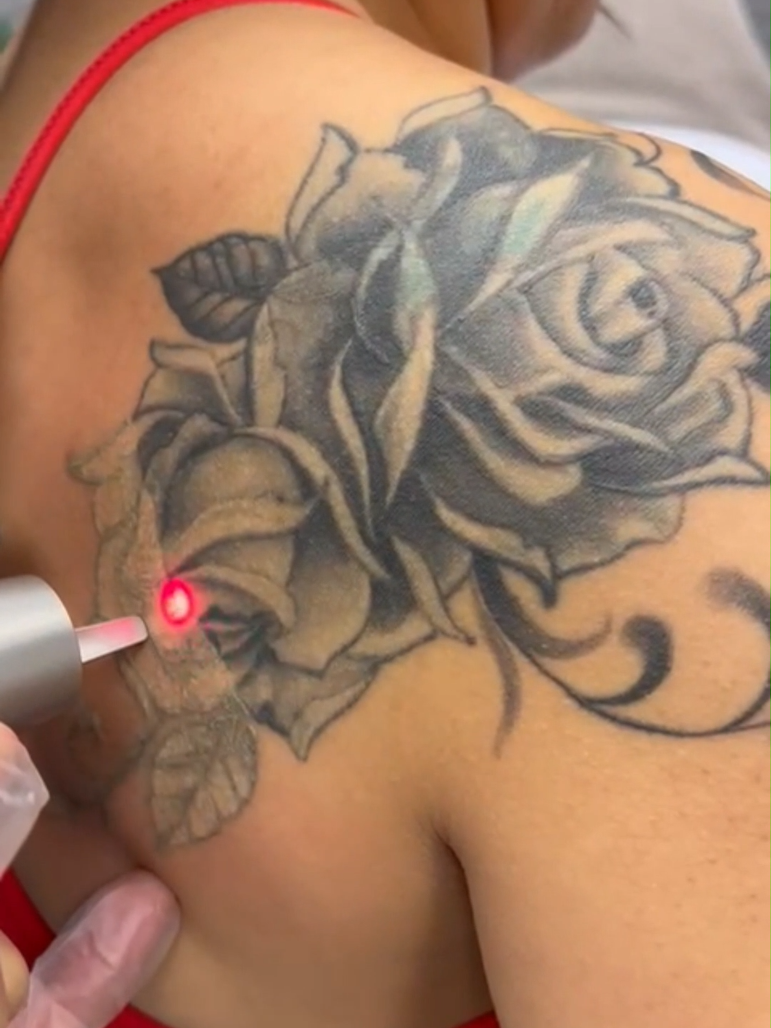 Tattoo regrets? We’ve got you covered #laseryou #TattooRemovalUK #LaserTattooRemoval #TattooRegret #TattooTransformation #TattooFree #UKBeauty #TattooRemovalJourney #SkinCareUK #BeautyInTheUK #LaserTreatment  #FreshStart #UKBeautyCommunity #SkinCareGoals #TattooErase #laserskincareclinicburnham #slough #westlondon #fypUK #foryouUK