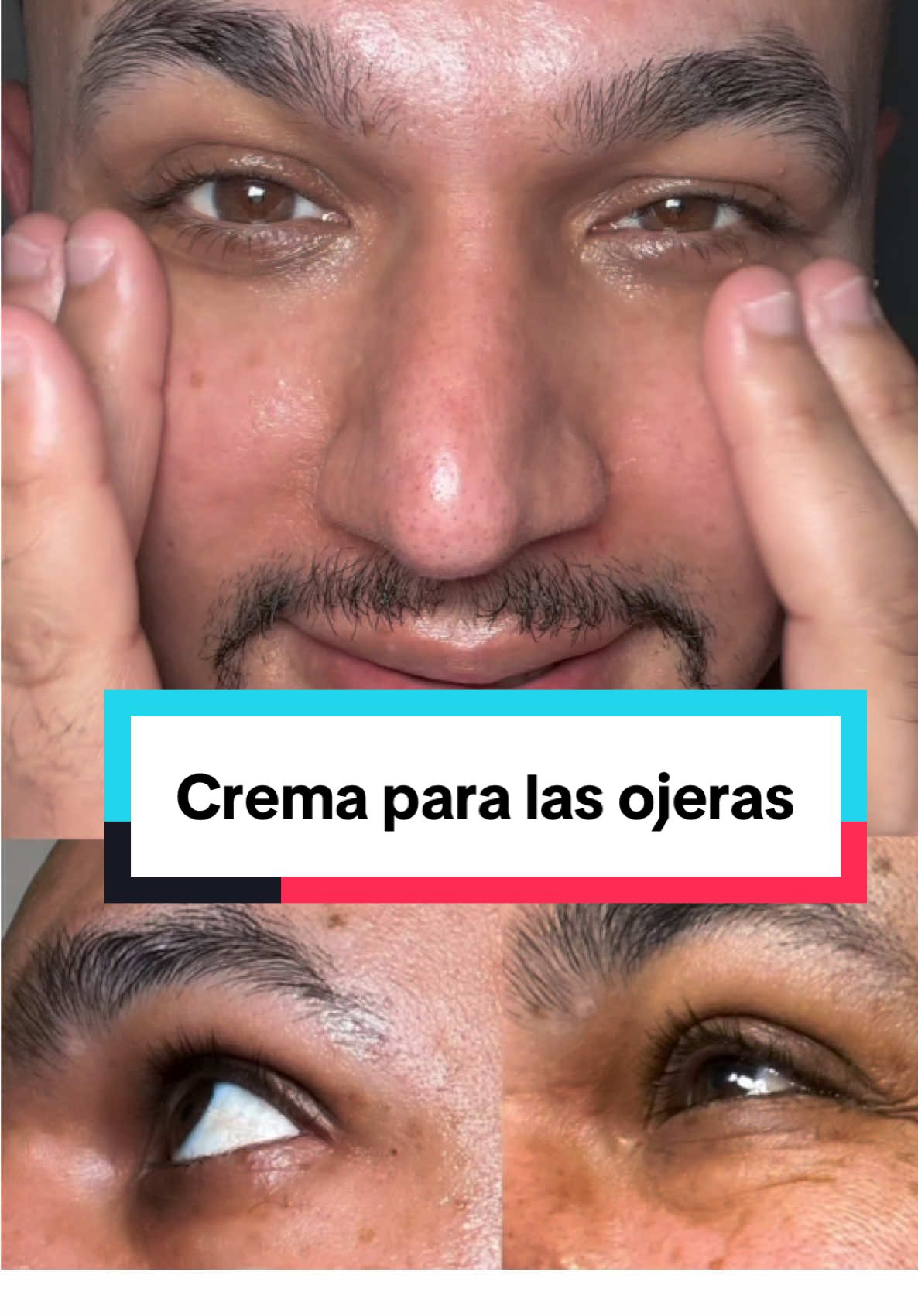 Cremas para las ojeras #ojeras #thephix #thephixcaffeineeyecream @the pHix 