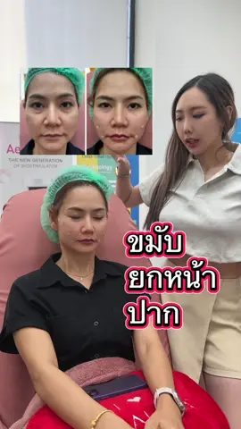 ขมับ ยกหน้า ปาก 5 cc #หมอป๊อปยกหน้า #เสาบ้านหมอป๊อป #ปรับรูปหน้า #ใต้ตาหมอป๊อป #ร้อยไหมหมอป๊อป #ฉีดปากหมอป๊อป #ไหมน้ําหมอป๊อป 