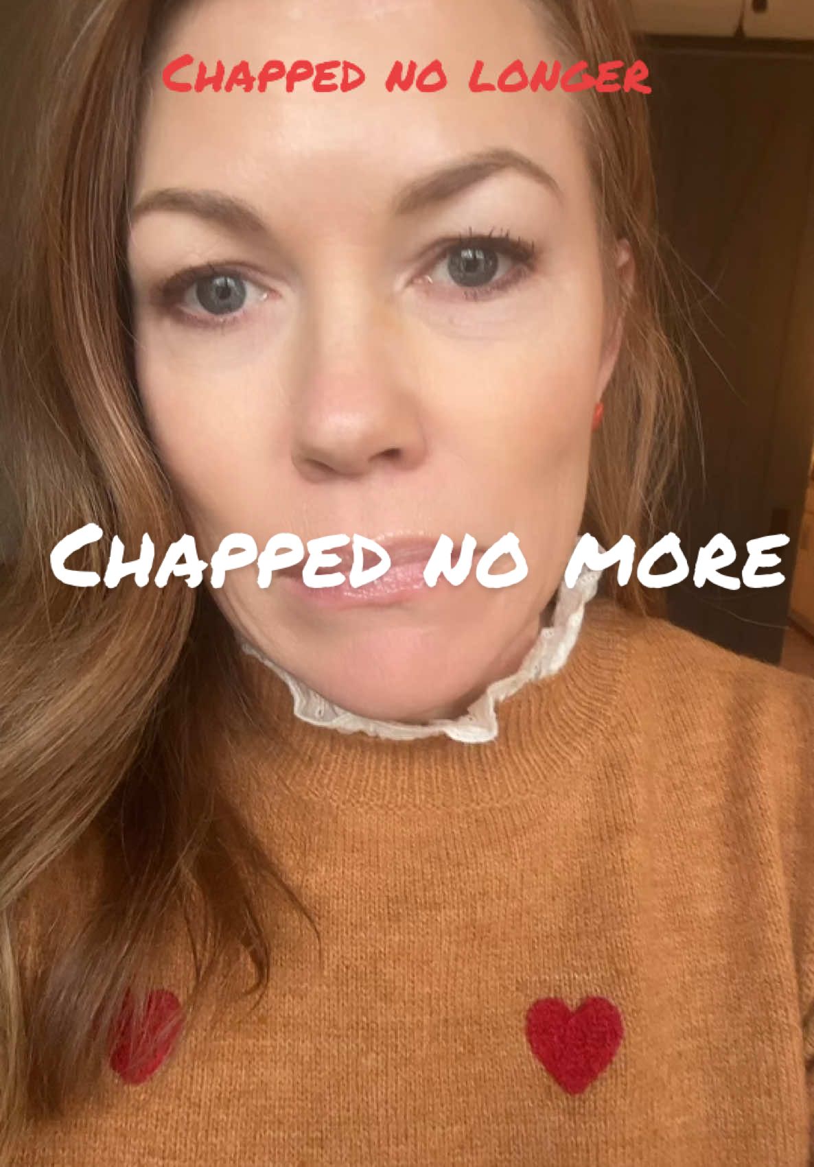 This is the only thing I use for winter months for those terribly chapped lips and skin. #drylips #chappedlipsnomore #chappedlips #chappedskin #dryskin 