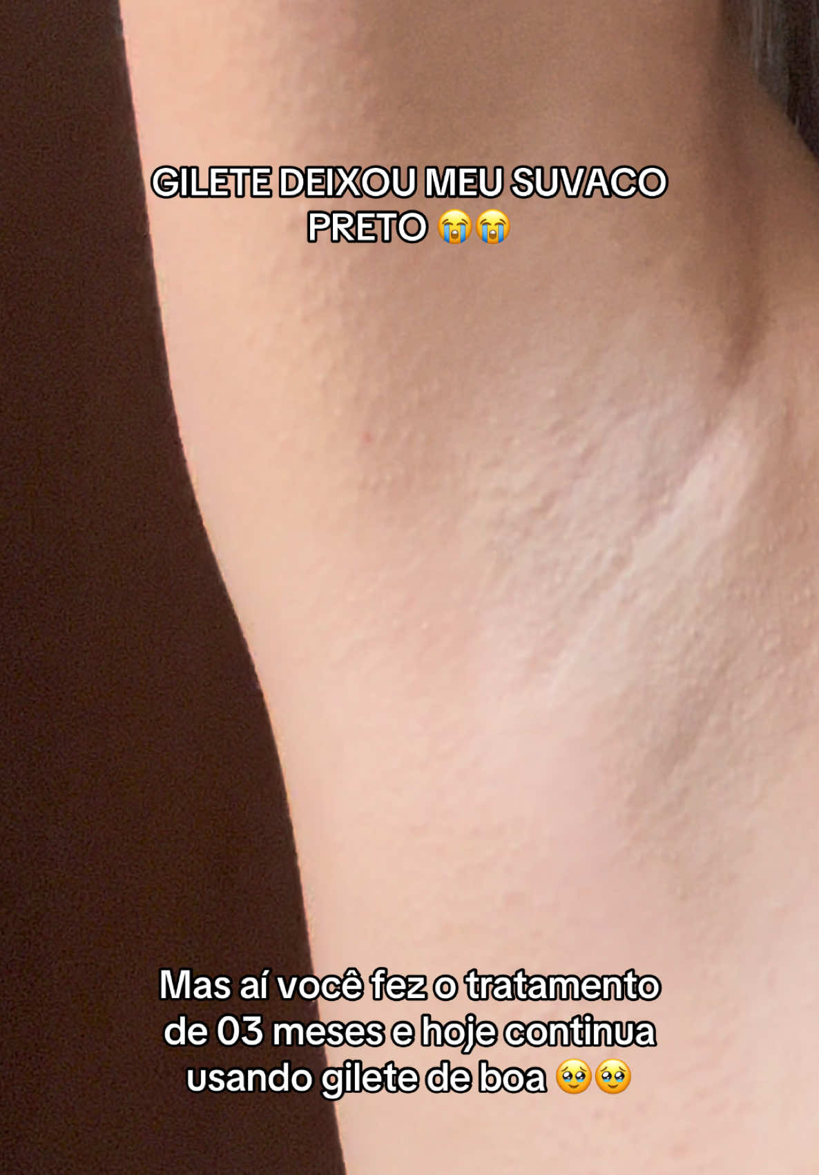 Demorou, mas eu conseguir!  #axilasoscuras #clareador 