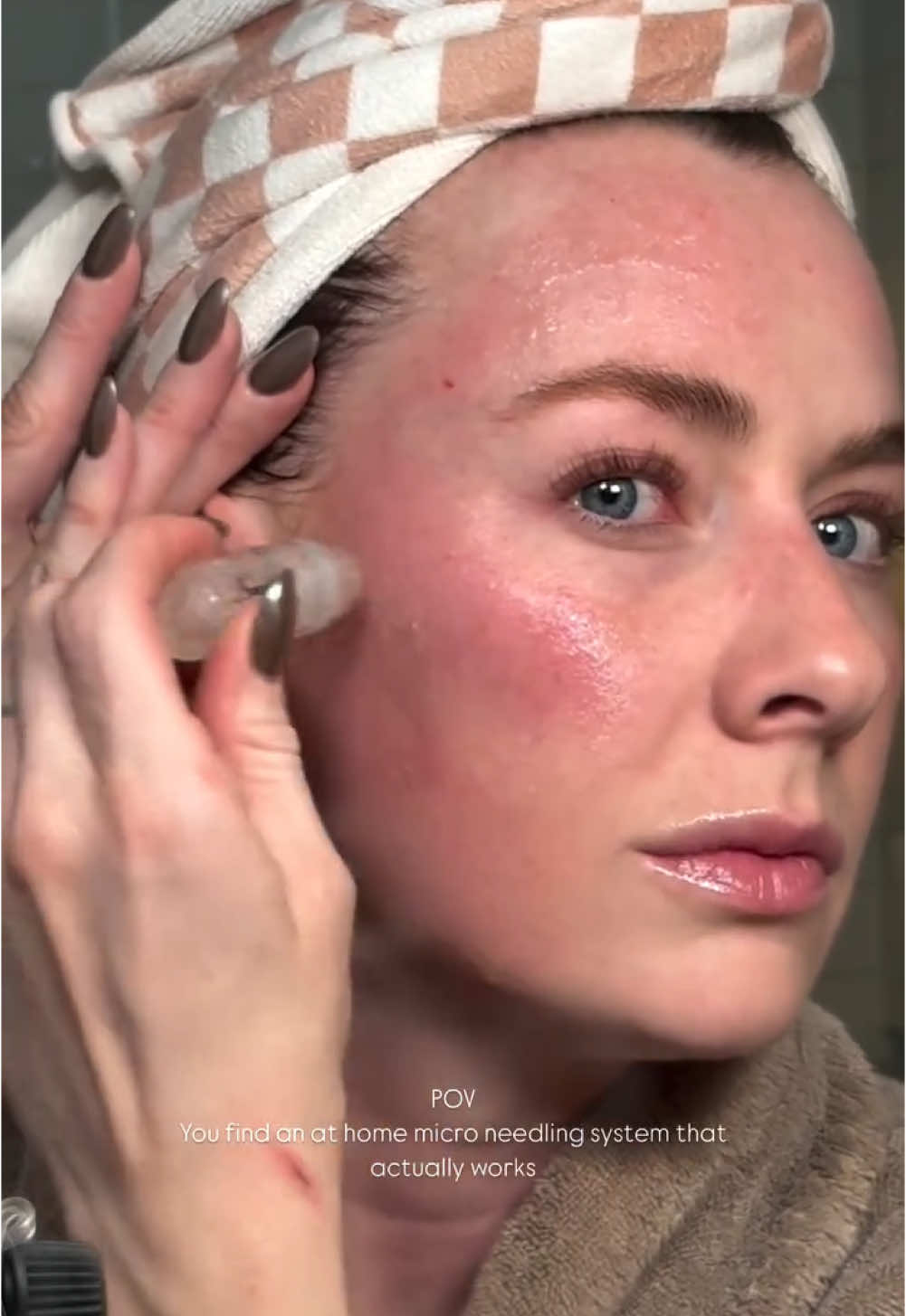 Ok @Qure™ Skincare I’m in ##microneedlingtherapy #microneedlingface 