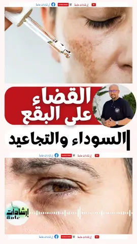 وصفة للقضاء على البقع السوداء والتجاعيد وصفات نصائح وإرشادات الدكتور عماد ميزاب wasafat Docteur Imad Mizab 