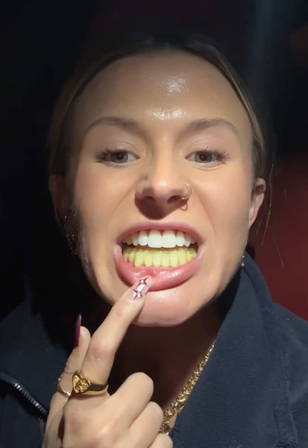 Namastained 😬#turmeric #teeth #yoga #invisalign #stained #funny #highlighter #yellow #collab 🎥: carlihenderson