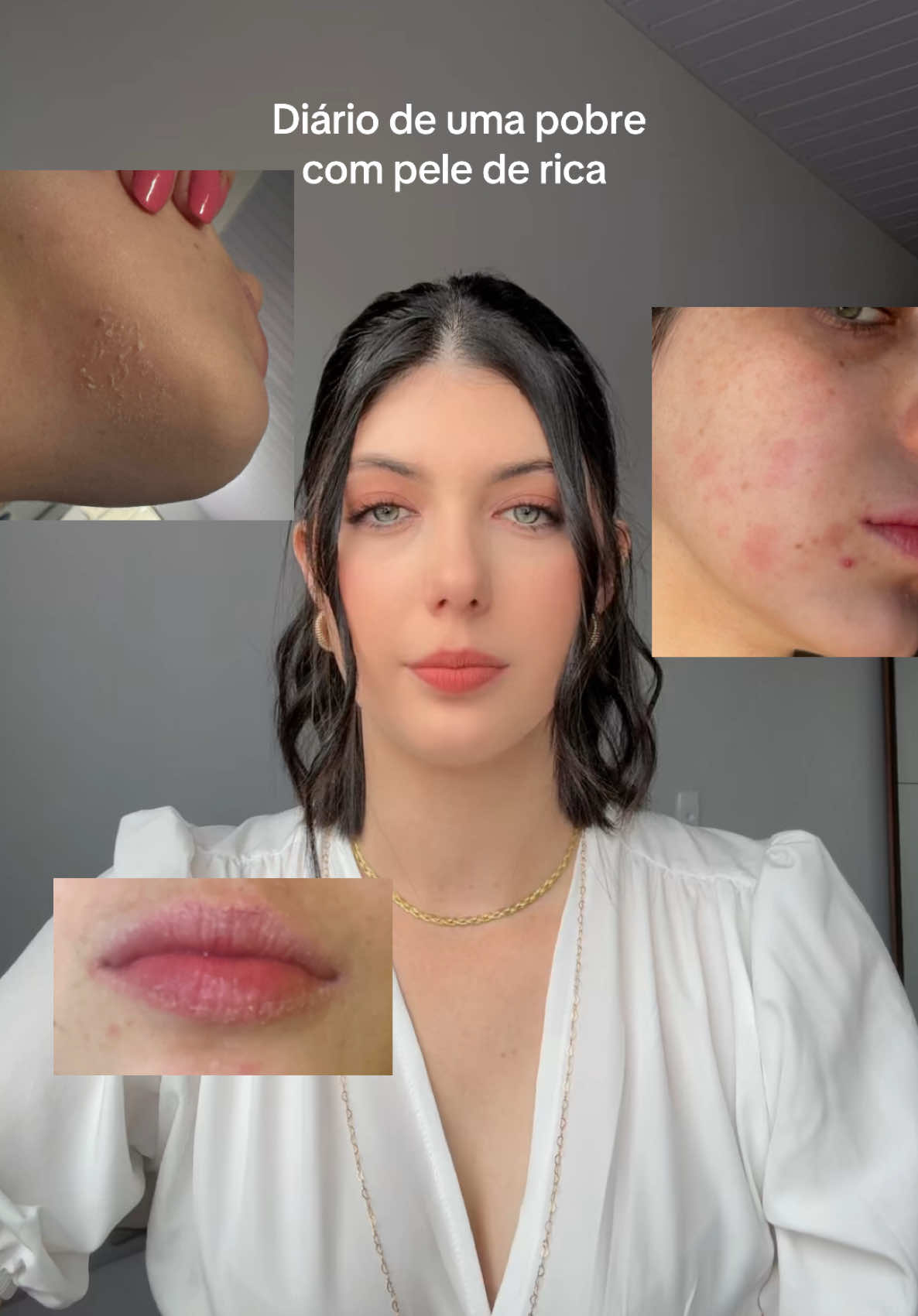 Querida pele: EU NÃO SOU HERDEIRA, recomponha-se 🥵 #foryoupage #dermatite #patchteste #dermatologia #dermatiteperioral #dermatitisseborreica #dermatitisporcontacto #fypage #alergia #testedealergia 
