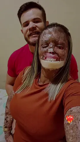 Nosso dia #28  hoje completamos 7 ano juntos ❤️‍🔥🙏🏼 #CapCutAmor #CapCutCasal 