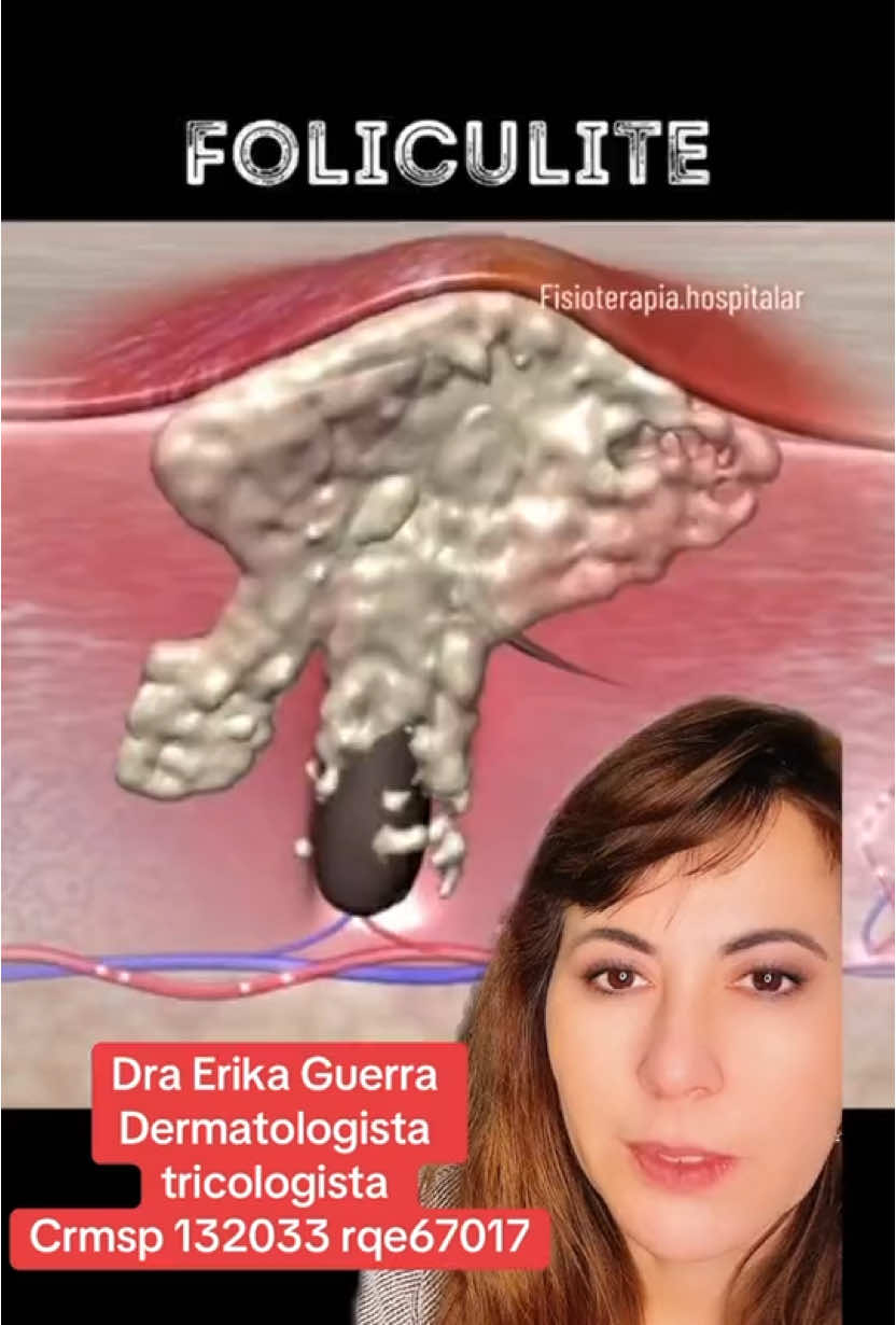 #qualyskin #draerikaguerracrm132033 #irmasguerradermatologistas #draelaineguerracrm101044 #dermatologist  