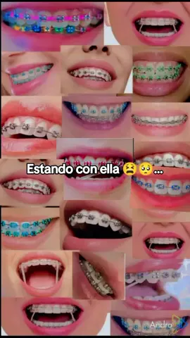 #brakets #cosasquenopodemoshacer 🙃😩