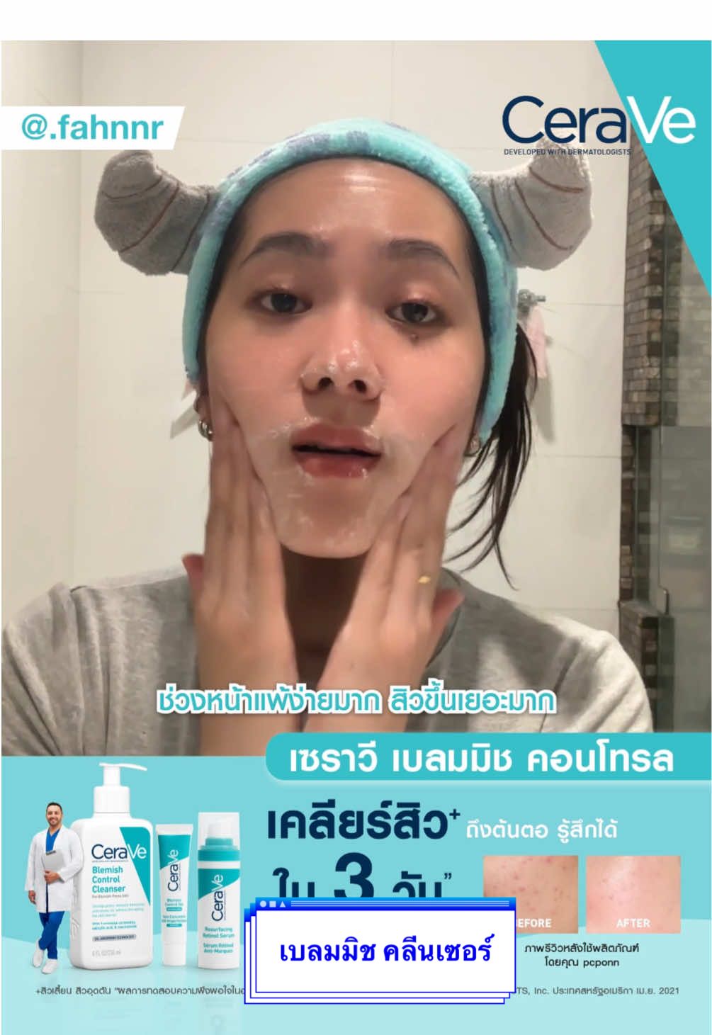 ช่วงนี้ PM2.5 เยอะมาก แพ้ง่าย สิวขึ้น แนะนำ เซราวี เบลมมิช คอนโทรล คลีนเซอร์👑 เหมาะกับคนเป็นสิวผิวมัน ดูแลผิวจากฝุ่นจิ๋ว ปราการผิวแข็งแรง 💚 #อย่าบีบเซราวีเคลียร์สิวหมอผิวแนะนำ #CeraVeThailand 