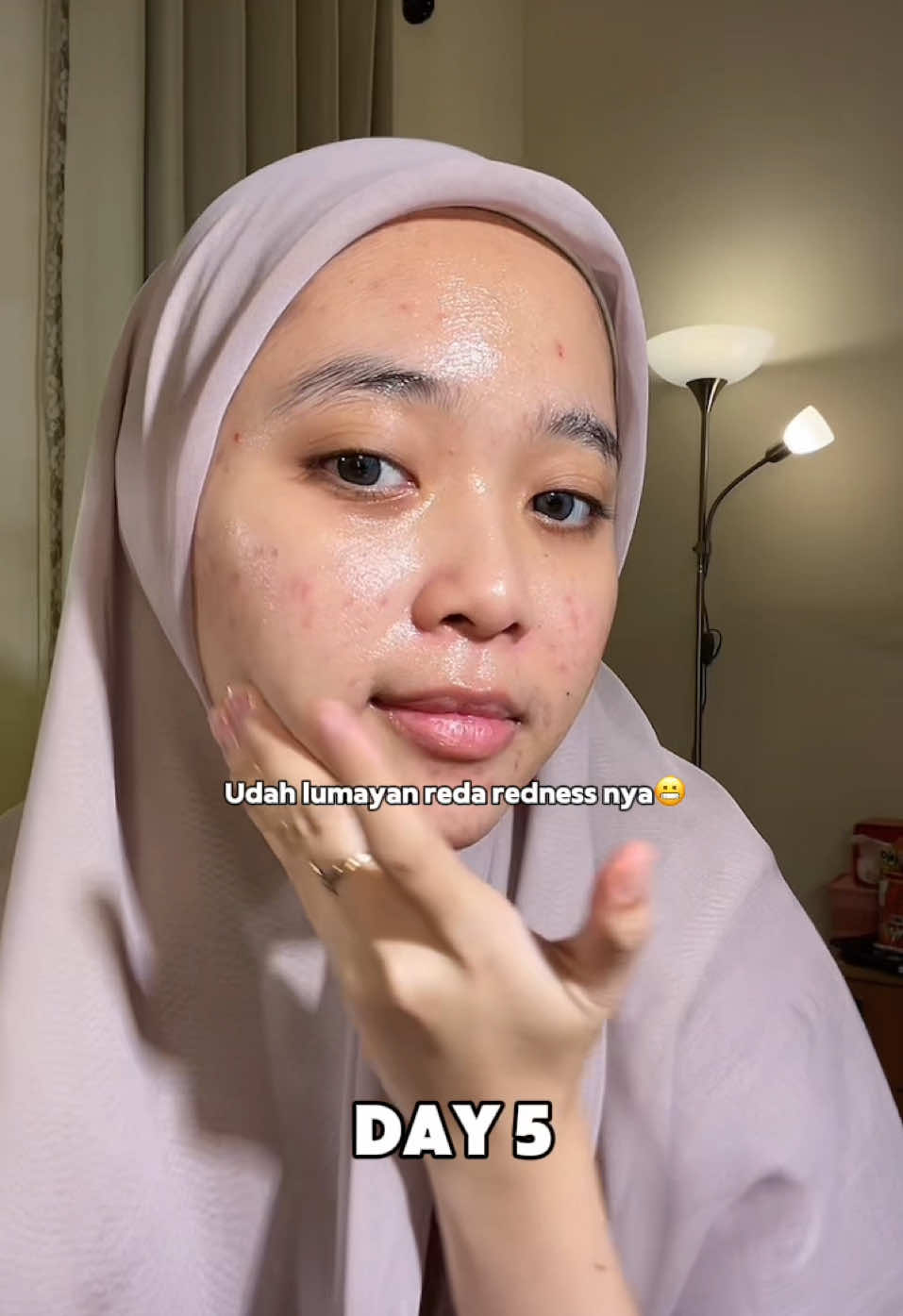 #maasyaaallah redness nya berkurang banget🥹 #moisturizer #redness #acneskin #theoriginot 