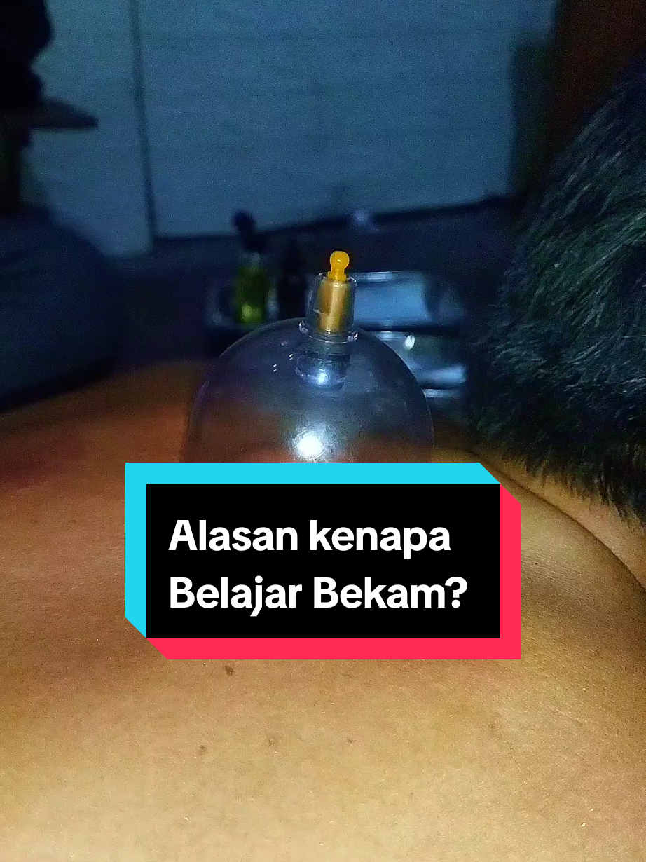 Belajar salah satu dari thibbun Nabawi yaitu bekam bukan hanya didasari faktor cuan atau ekonomi, tapi yang paling banyak adalah guna menyehatkan keluarga,  yuk belajar bekam, minimal untuk keluarga dirumah...  #bekamsunnah #bekamsayattipis #bekambasah #pelatihanbekam #bekampontianak 