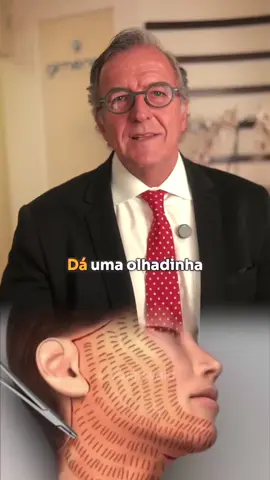 Safety in facial surgeries is our priority. That's why we use the hemostatic net, a technique created by two brothers from Curitiba, great friends and experts in plastic surgery. Today, this innovation is used by surgeons all over the world due to its numerous benefits: reduced bleeding, bruising and swelling, in addition to providing a faster and smoother recovery. At first, I confess that I was reluctant to use it, because I believed that patients might not adapt to the presence of the net in the first 48 to 72 hours. But that didn't happen. The benefit is so evident that patients value the superior results it provides. Today, I use the hemostatic net in almost 100% of facial surgeries, bringing more safety and efficiency to the post-operative period. Innovation that transforms results and takes care of you. #PlasticSurgery #DrRodrigoGimenez #HemostaticNetwork #FacialSurgery #Innovation #Safety #Aesthetics #Health 