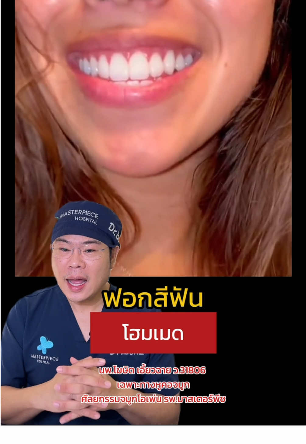 #longervideos #หมอเบ็นซ์masterpiece #หมอเบ็นซ์แก้ได้ #หมอเบ็นซ์nose_recon #รู้จากtiktok #TikTokUni #ข่าวtiktok #เรื่องนี้ต้องดู 