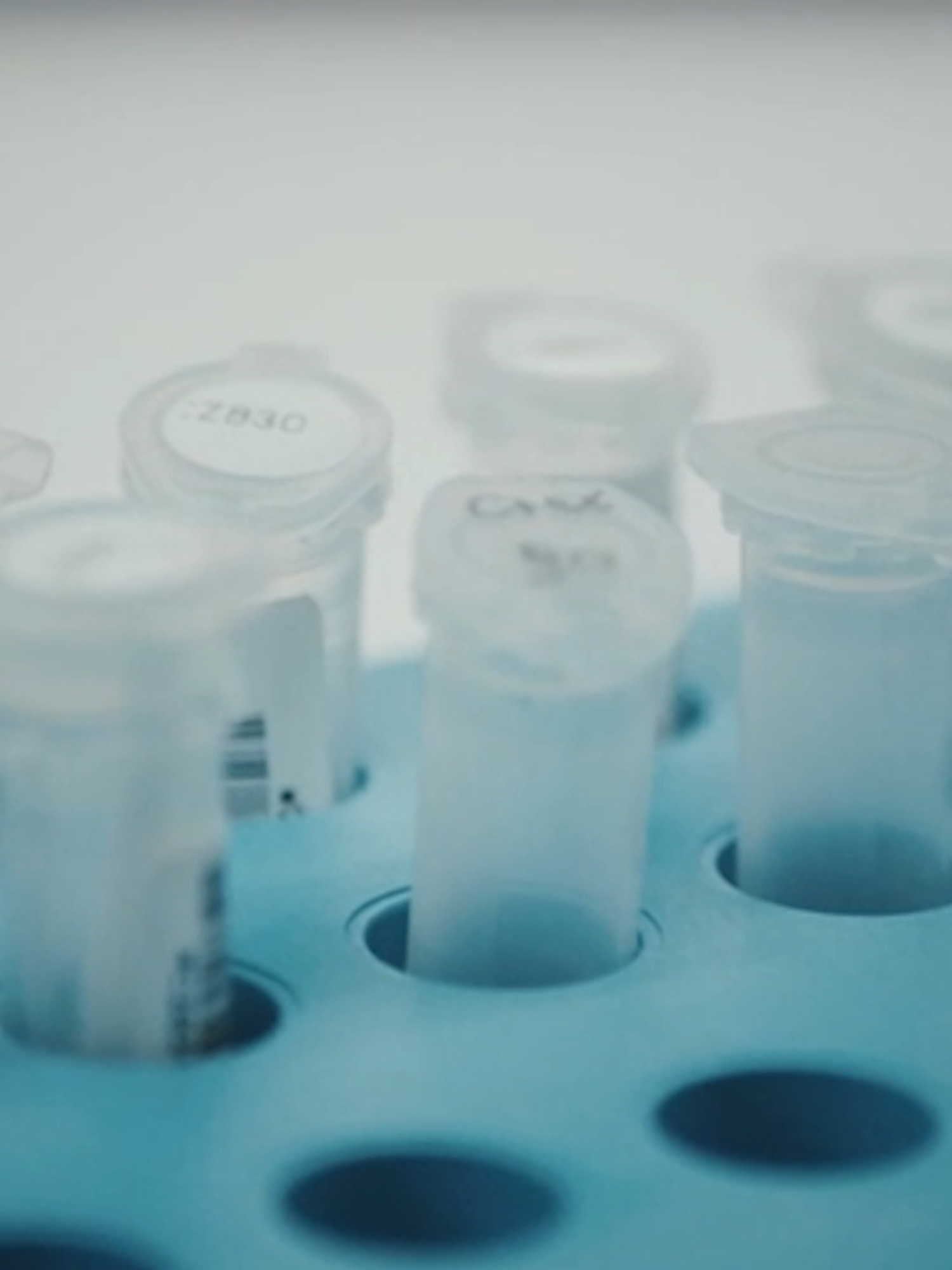 De Belgische seriemoordenaar S. Du Lion werd dankzij een DNA-match na 30 jaar eindelijk gepakt 🧬 #dna #truecrime #whattowatch