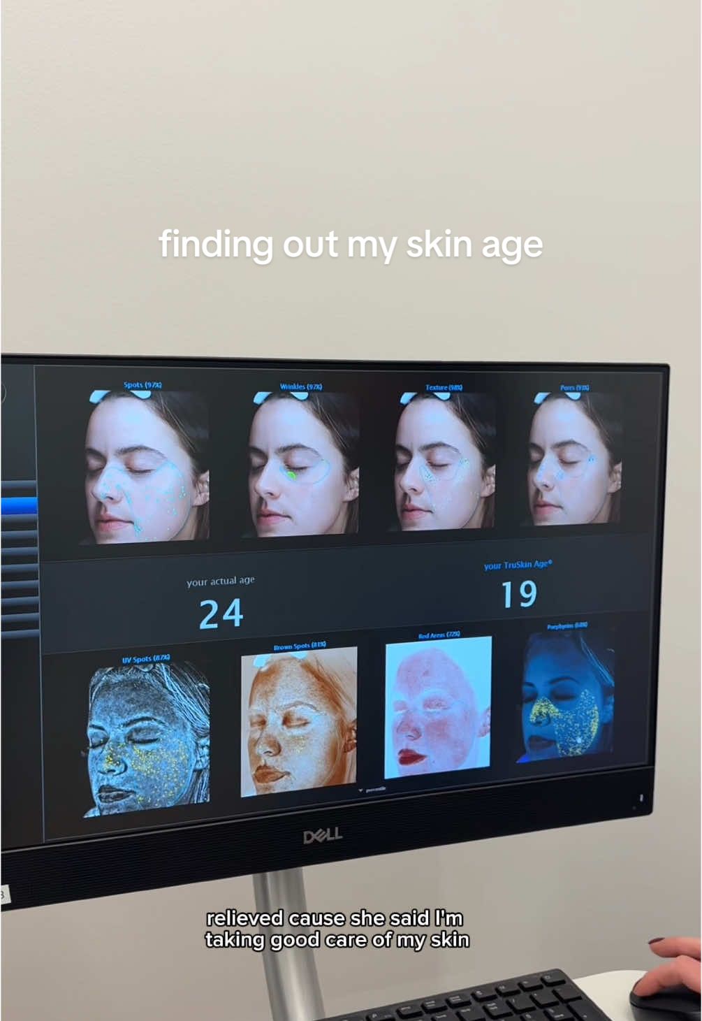 come find out my skin age with me at @FabRxStudioNYC (use my code ISABELLA-533917 for $50 off) ❣️ #skinage #aerolase #facial #visiascan #collagen #wrinkles #uvspots #hyperpigmentation 