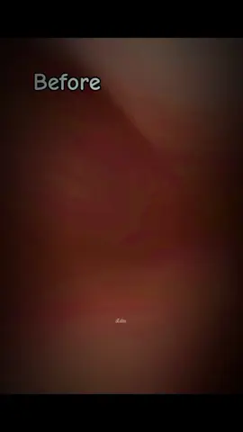 #CapCut 