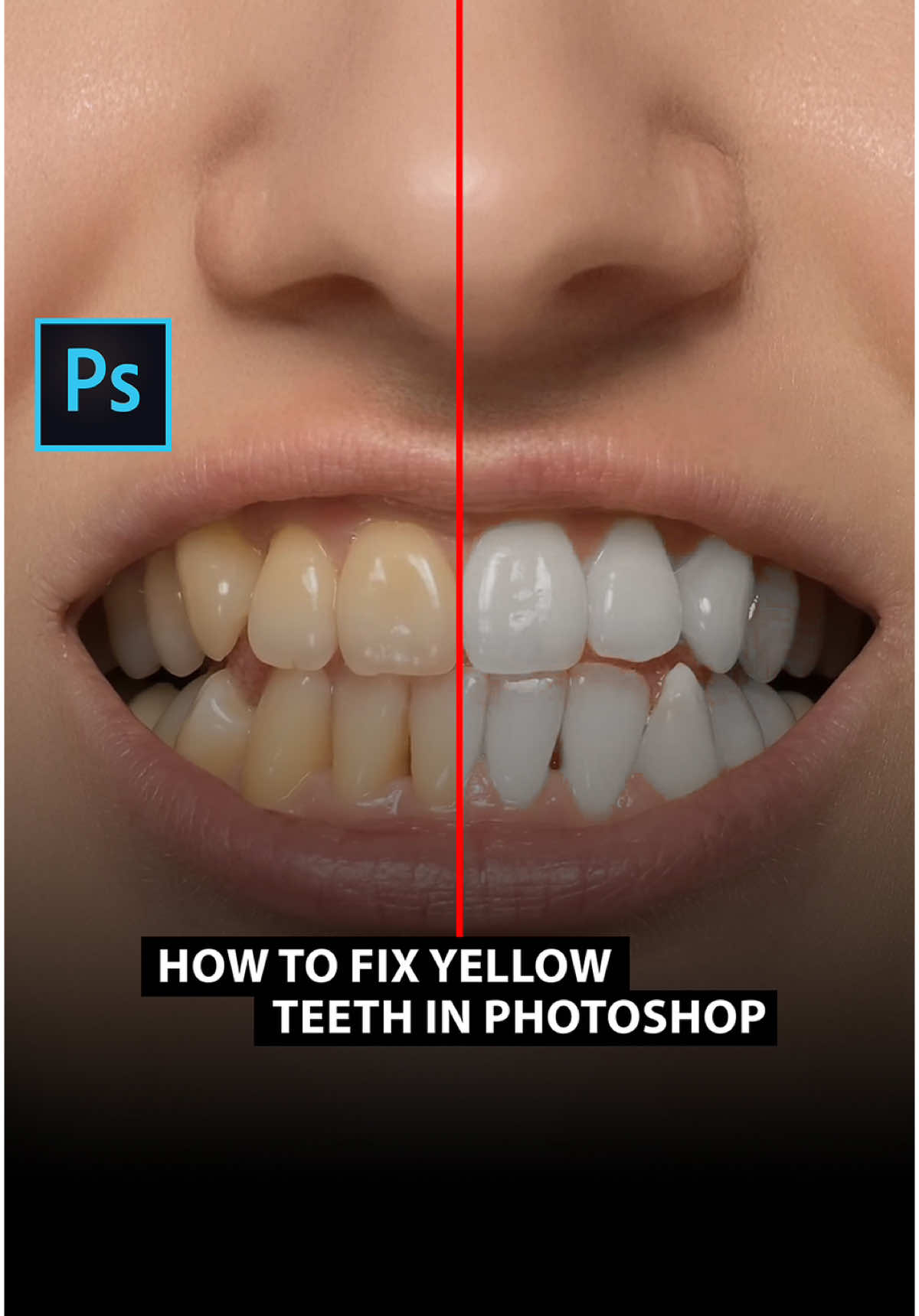 How to fix yellow teeth in Photoshop 😁🦷 . . . . #photoshop #photopraphy #art #design #tutorial #digitalart #photoshoptutorial #graphicdesign #graphicdesigner 