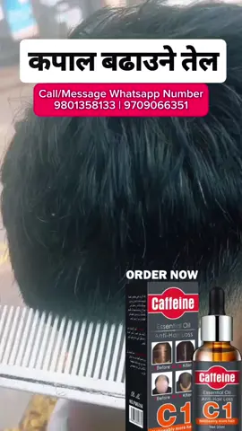 CAFFEINE HAIR GROWTH OIL✅ . . . . . #fyppppppppppppppppppppppp #nodeliverycharges #freehomedelivery #fyp #ordernow #foryoupage #viralvideo #goviral #nepalitiktok #tiktoknepal🇳🇵 #skinresilience #koreancosmetics #antihairfall #longhair #hairgrowthoil #essentialhairoil #caffeinehairgrowthoil #alopecia #alopeciatreatment #aloepeciatreatmentinnepal #kathmandu #Love #support #growmyaccount #hairgrowthsolution #hurryup #beautifulhair #lovelonghair #placeyourorders 