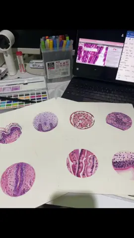 💉🎨#medtech #tissues #medtechstudent 