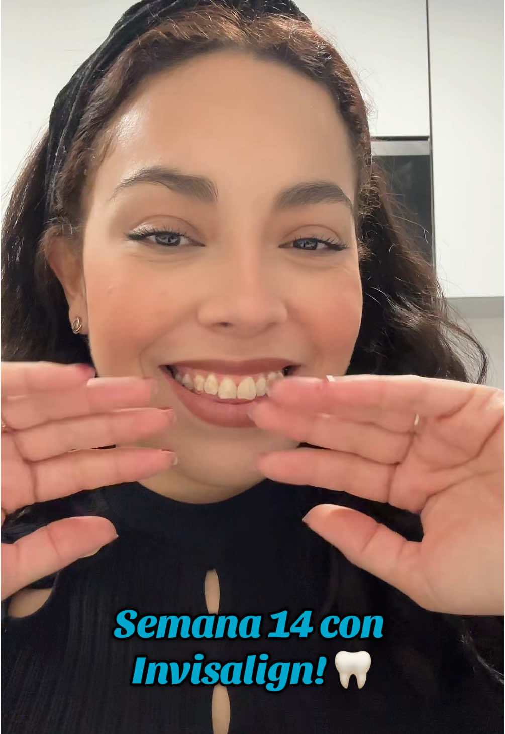 Parte 14 | ASMR 🦷 Alinedores nuevos !!! 🦷 semana 14 con Invisalign! Me han puesto ya las gomillas, tengo que llevarlas todo el día y la noche. 😬 #dientesperfectos #ortodonciainvisible #invisalign #ASMR #alineadoresinvisibles #invisalign 