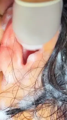 #microcore #Non #How #new #NurseUnderstandNurse #newborn #tutorial 