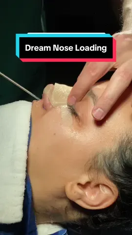 Message us to learn more about #barbienose 👃🏻💗 #rhinoplasty #nosejobcheck #nosejob #rhinoplastyistanbul #nosejobturkey #rinoplastia #nasenkorrektur #cindynose #rhinoplastyturkey 