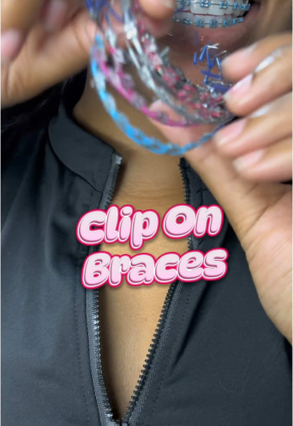 Hey Pookie 🤭 Clip On Braces on sale. Link in bio or visit 14ksmiles.com. Prices start $20 USD 