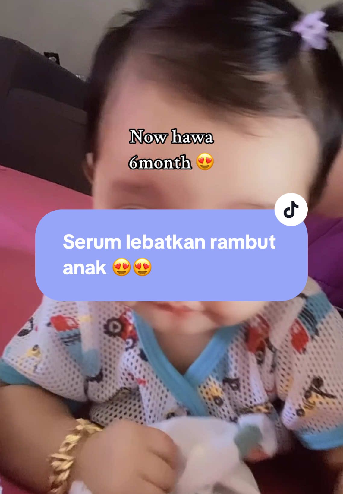 Serum yang boleh lebatkan rambut anak 🧚🏻‍♀️ lagi2 yang baru lahir tu. Boleh hilangkan daki2 kat rambut anak pluss rmbut cepat panjangg 😍 bestkann mommies. Cepat grab now😍😍 #babyhair #serumummialya #serumhairummialya 