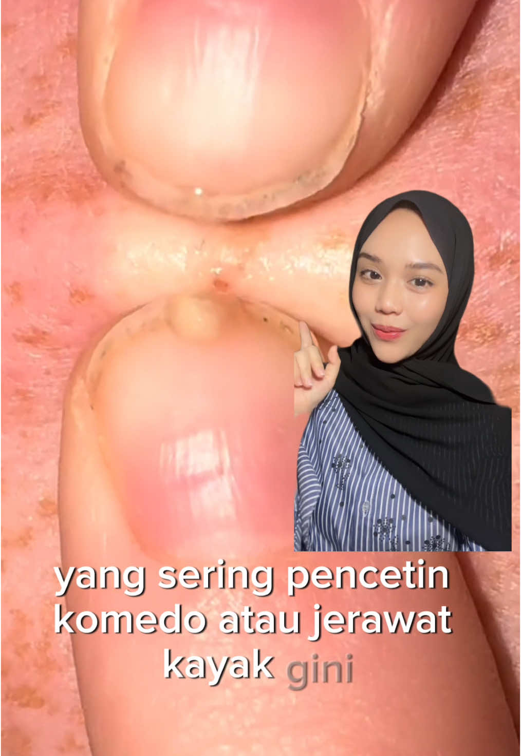 @MOOI Pure Glow ID #combobrighteningmooi #mooipureglow #brighteningserum #collagendrink #skincare #kulitkusam #glowinginlove #bestieglow 